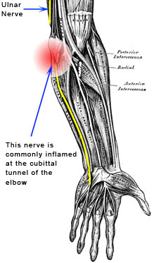 Ulnar Nerve Injuries