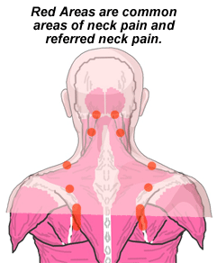 Neck Pain