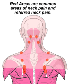 Neck Pain - Groschan & Associates Physical Therapy - Lutherville-Timonium,  MD